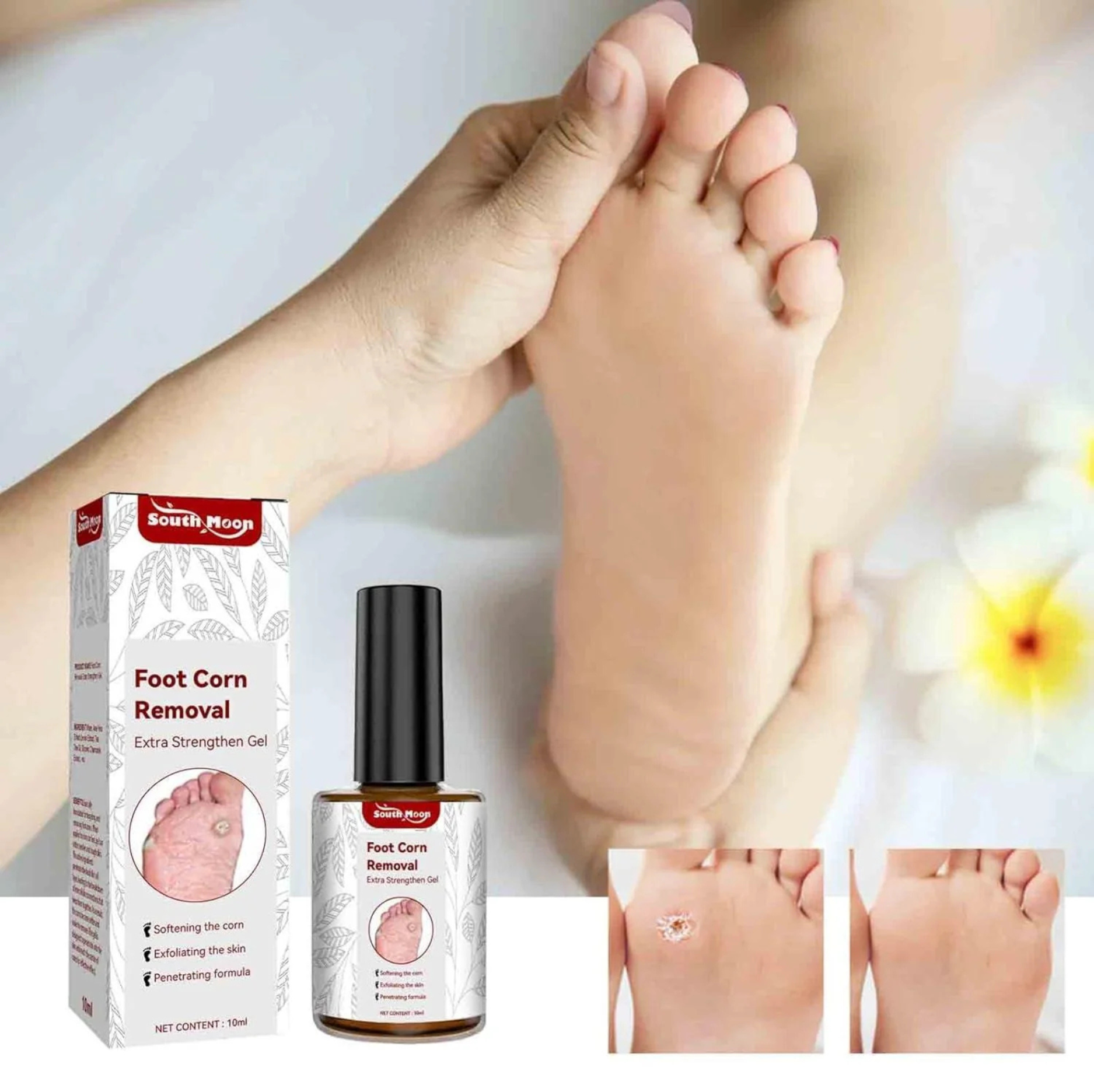Feet Corn Removal Serum 30ml ( Pack Of 1 )