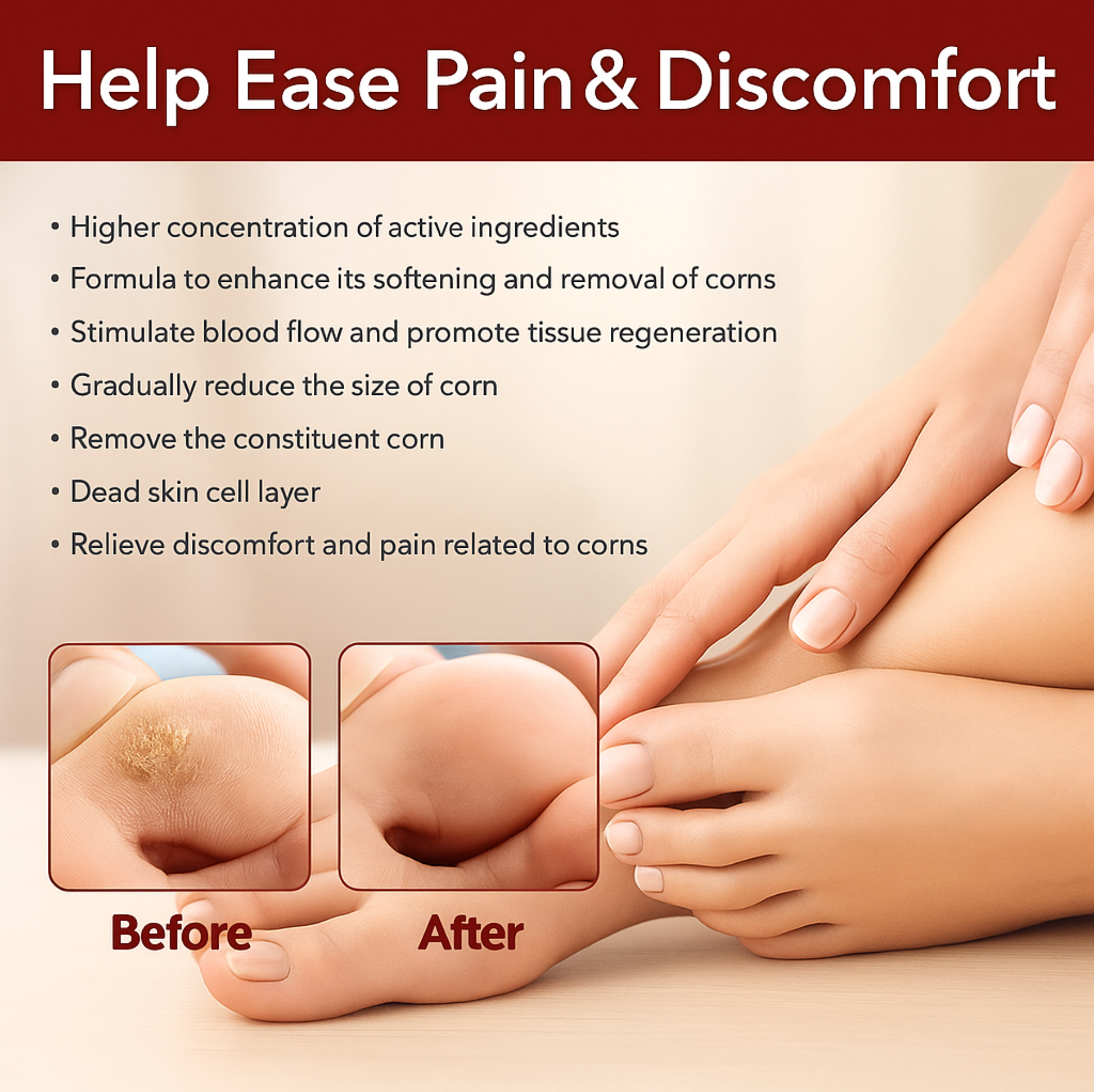 Feet Corn Removal Serum 30ml ( Pack Of 1 )